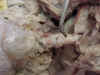 CervicalSpine.jpg (31035 bytes)