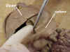 Spleen1.jpg (36296 bytes)