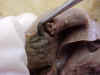 gallbladder2.jpg (25591 bytes)