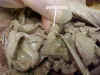 pancreas.jpg (49542 bytes)