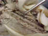 spinalcord.jpg (28980 bytes)