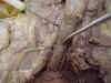 trachea2.jpg (39648 bytes)