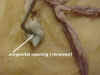 urogenremoved.jpg (36299 bytes)